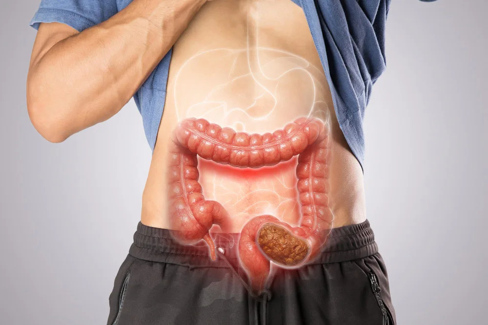 Alteraciones del funcionamiento del tracto digestivo